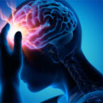 epilepsia